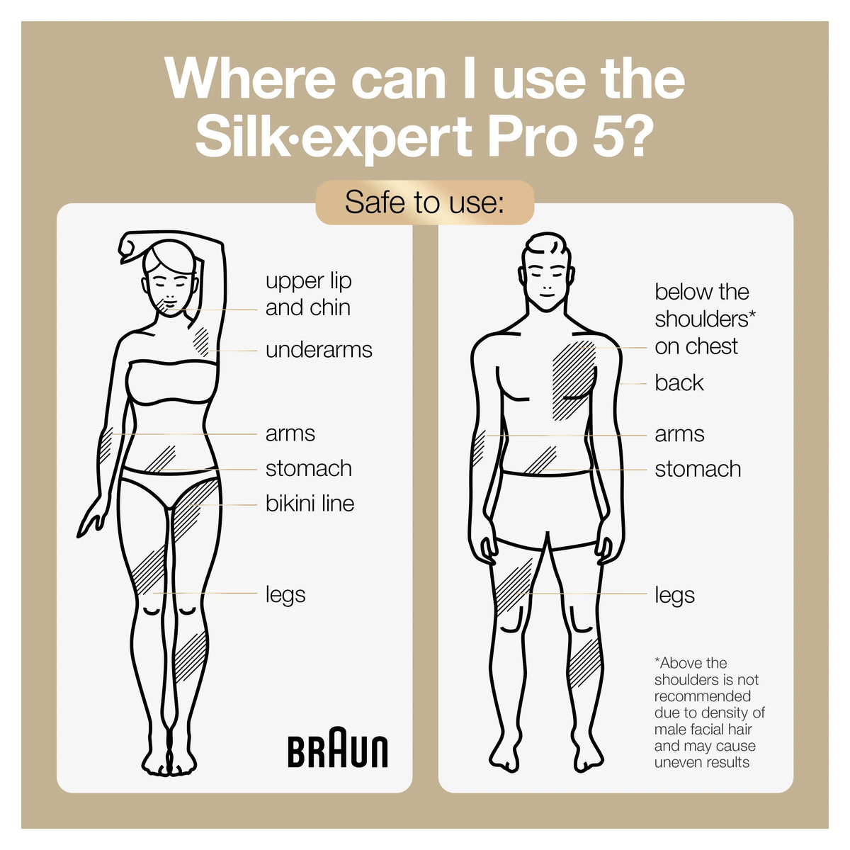 At-Home Hair Removal System U1444